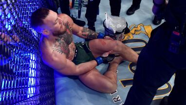 Conor McGregor przeszedł operację po paskudnym złamaniu nogi